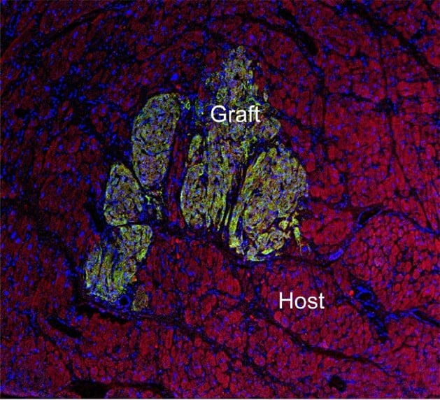 Heart Regeneration Research in Nonhuman Primates: A Model for Ventricular Pressure Overload Image